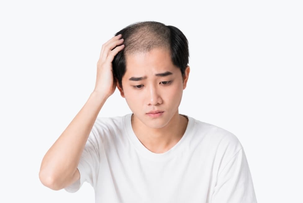 Thiếu hệ sinh thái, không chỉ sản phẩm